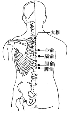 心悸的刮痧疗法