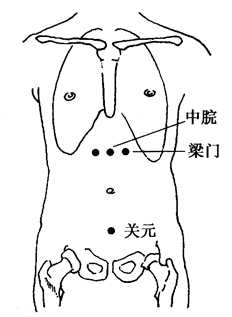 图2-12-3中脘、梁门、关元