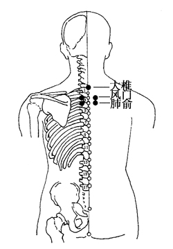 图6-1-1大椎、风门、肺俞