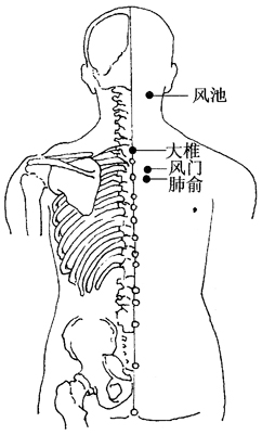 感冒的刮痧疗法