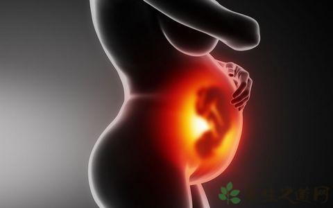 什么是胎儿母体输血综合征