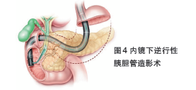 内镜技术（带图标）