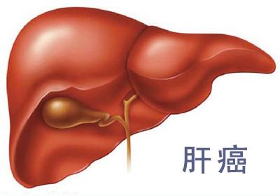 肝癌血压会升高吗