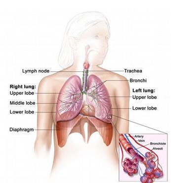 肺癌早期治疗