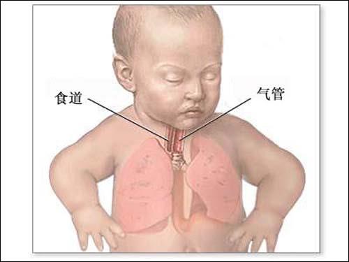 食道癌在不同的时期该如何饮食呢？