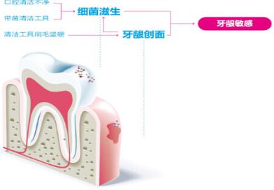 牙龈敏感如何刷牙